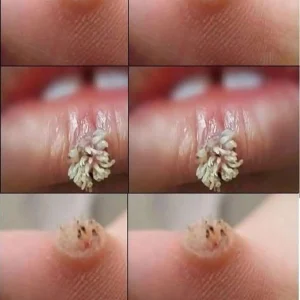 If your hands fall asleep it is a clear sign that you have c…