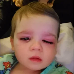 Mom issues warning after toddler nearly lost eyesight from bath toy