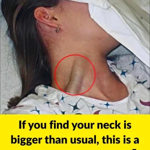 If you find your neck is bigger than usual, this is a sign you cannot ignore.