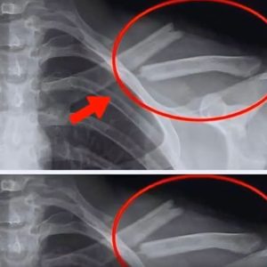 Ditching Diet Soda? Here’s What Really Happens to Your Body