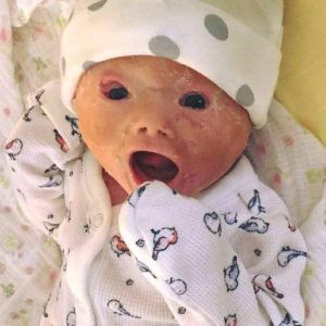 Mom shocked by her baby after birth, her words now spread like forest fire!