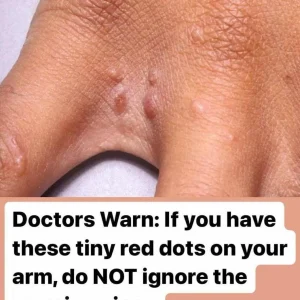 Itchy Red Spots on Your Skin? Don’t Ignore This Common but Misunderstood Condition