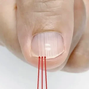 If you have these lines on your nails after 40, it is a clear sign that..