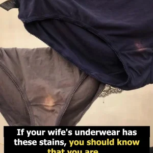 Everything You Need to Know About The Fluid That Comes Out Of