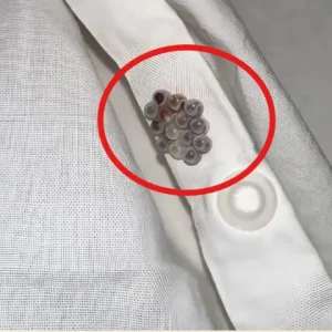 I Shocked when I discovered these small balls in my bed. Here’s what they were.