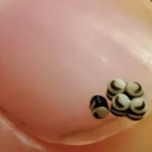 We ordered a salad, but there were tiny black specks in the food – we went straight to the hospital