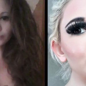 24-year-old woman wants the biggest lips in the world