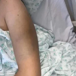 These are consequences of sleeping with…