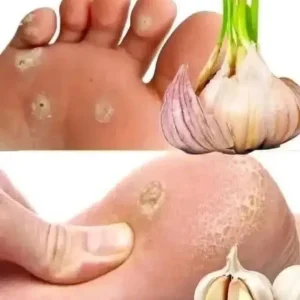 W.arning Signs on Your Feet and Natural Remedies to Care for Them