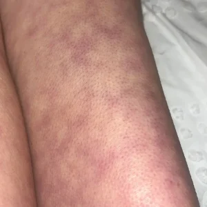 These are the consequences of sleeping with the…