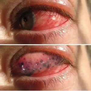 These are the main signs of this type of cancer!