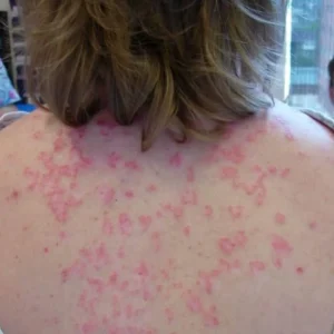 Here are the consequences of sleeping with…