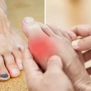 When the levels of cholesterol in your body are dangerously high, your legs will give you these 4 signs