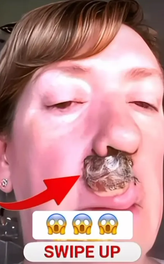 7 Skin Bumps You Might Mistake for Acne