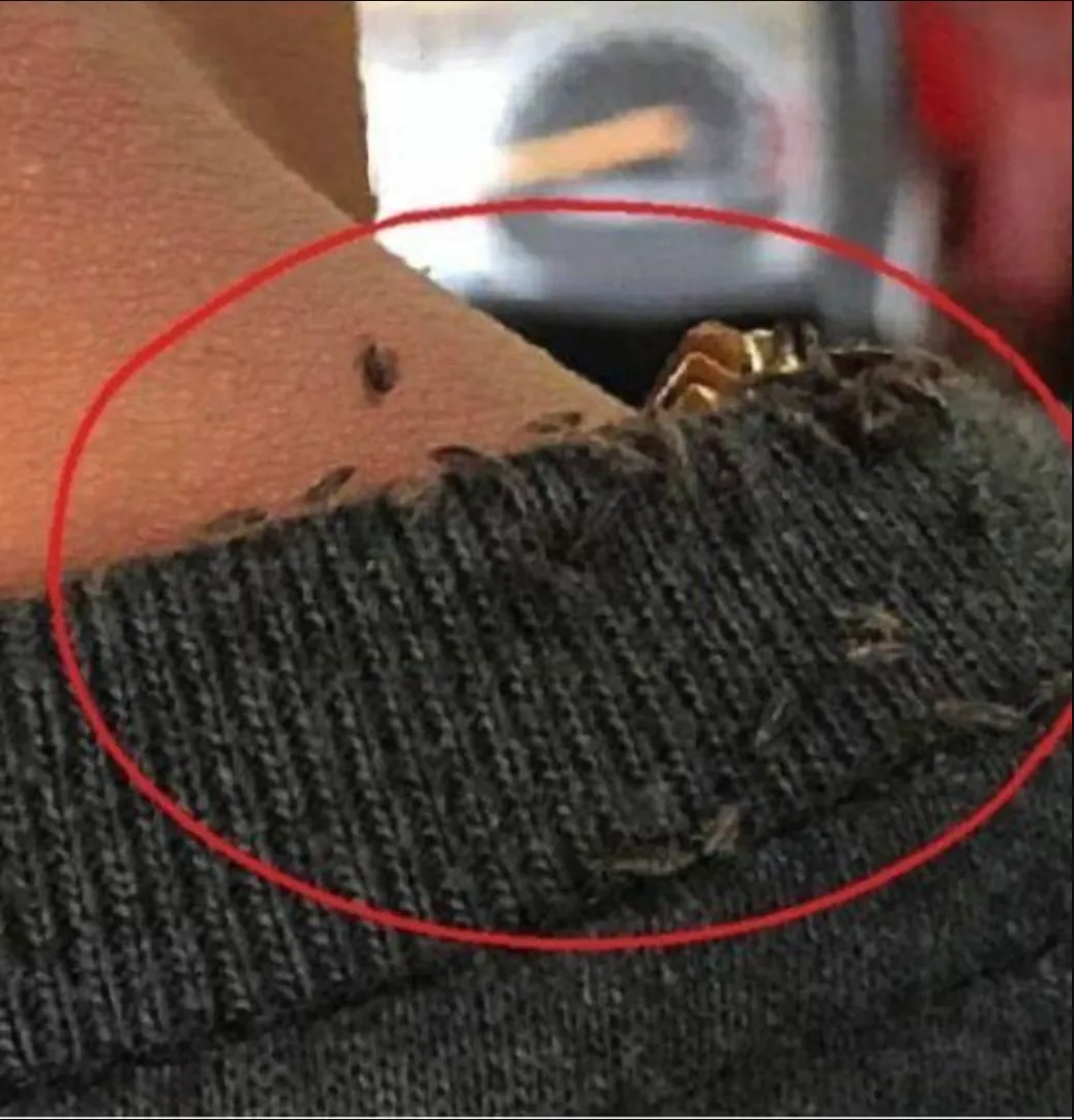 A Shocking Case That Crawled Across the Internet: The Viral Story of the Tricycle Driver With Severe Head Lice