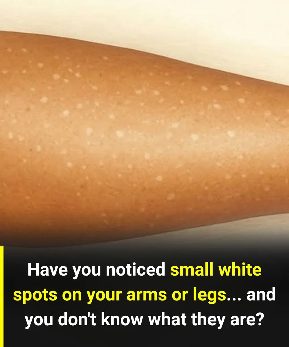 The Silent Signals On Our Skin What White Spots Reveal About Hidden Vitamin Deficiencies