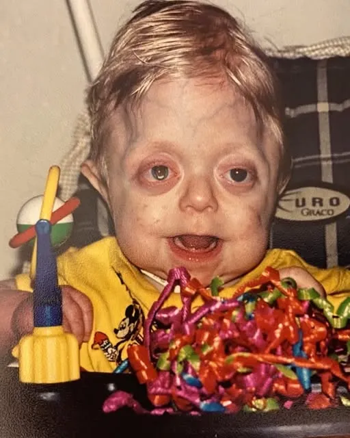 The Boy They Said Wouldn’t Live 18 Months Walks Across the Graduation Stage and Becomes a Firefighter