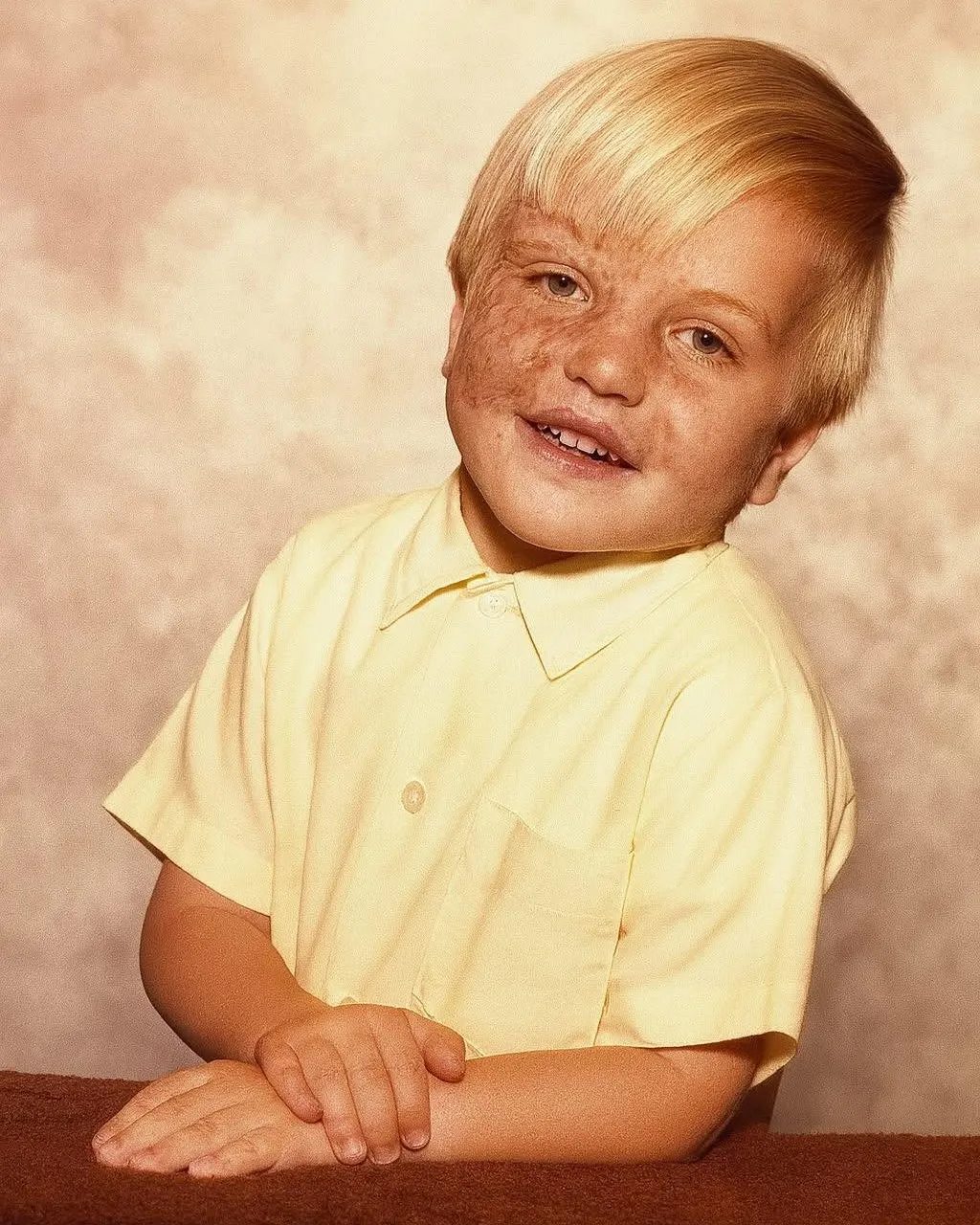 He Was Given Little Chance as a Baby in 1978 Now His Life Is Inspiring Thousands