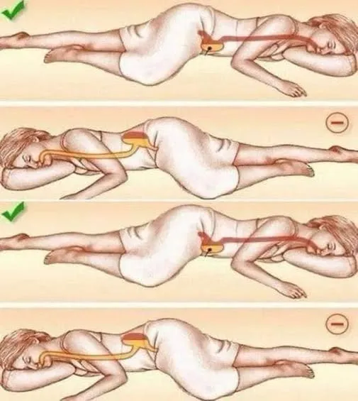 The Left-Side Advantage: How Your Sleeping Position Dictates Digestive and Organ Health
