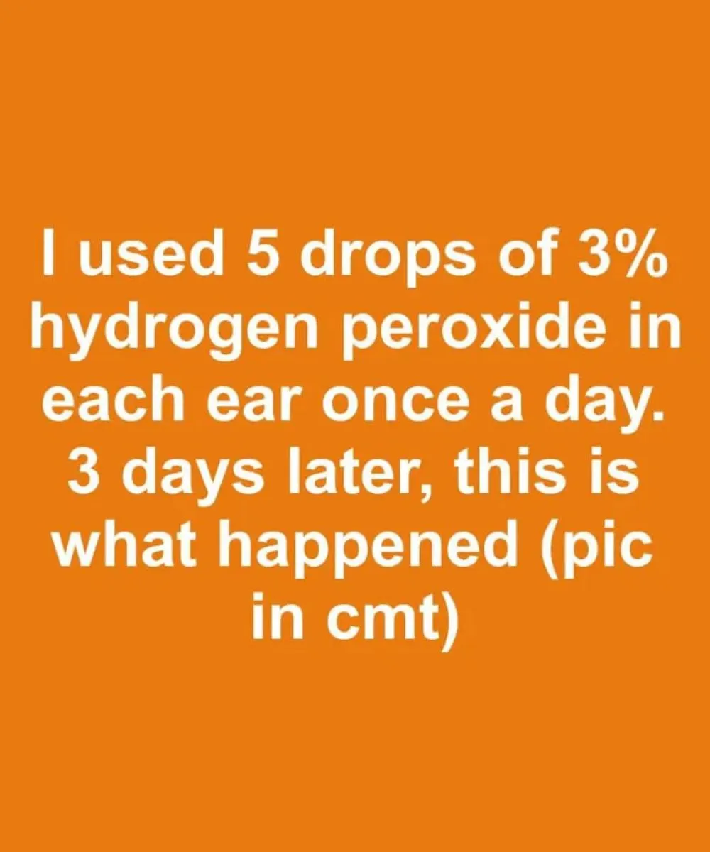 I Tried Five Drops Of Hydrogen Peroxide In Each Ear For Three Days And What Happened Surprised Me
