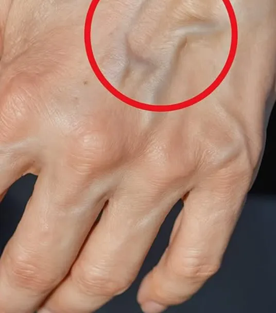 What Your Visible Veins Really Reveal About Your Blood Circulation Health