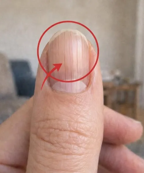 Surprising Secrets Your Fingernails Can Reveal About Your Health And Aging