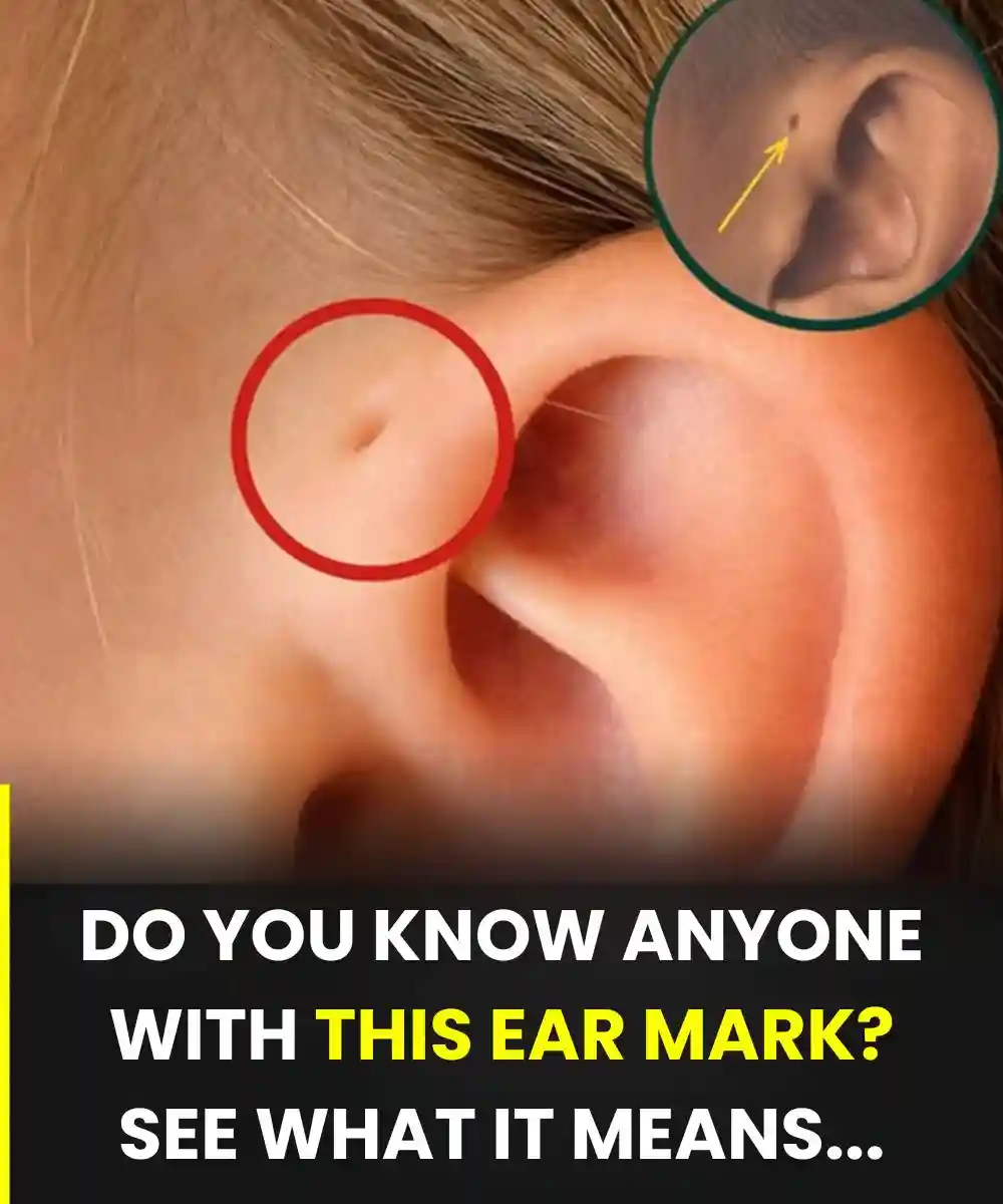 Tiny Holes Near Human Ears Might Reveal Fascinating Ancient Evolutionary Secrets